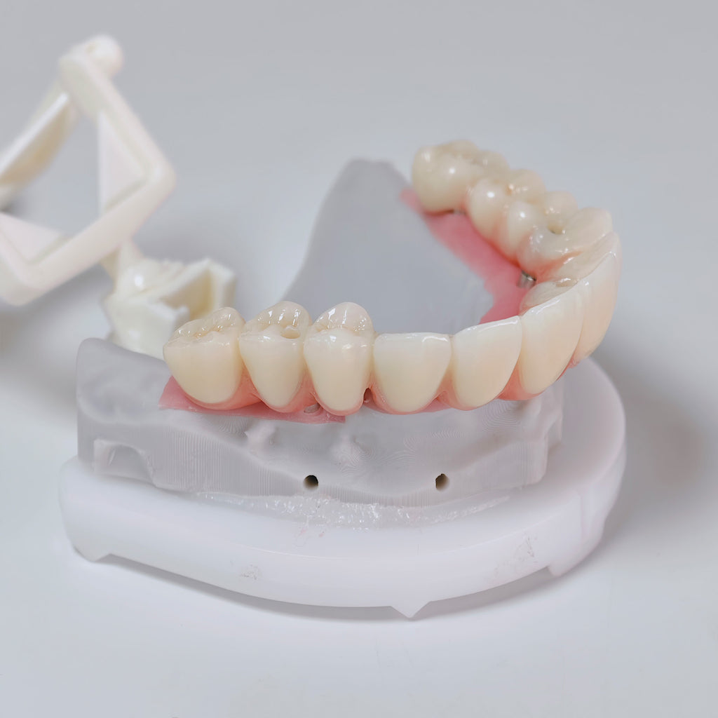 All On 6 Zirconia Bridge With Ti-Base Screw Retained
