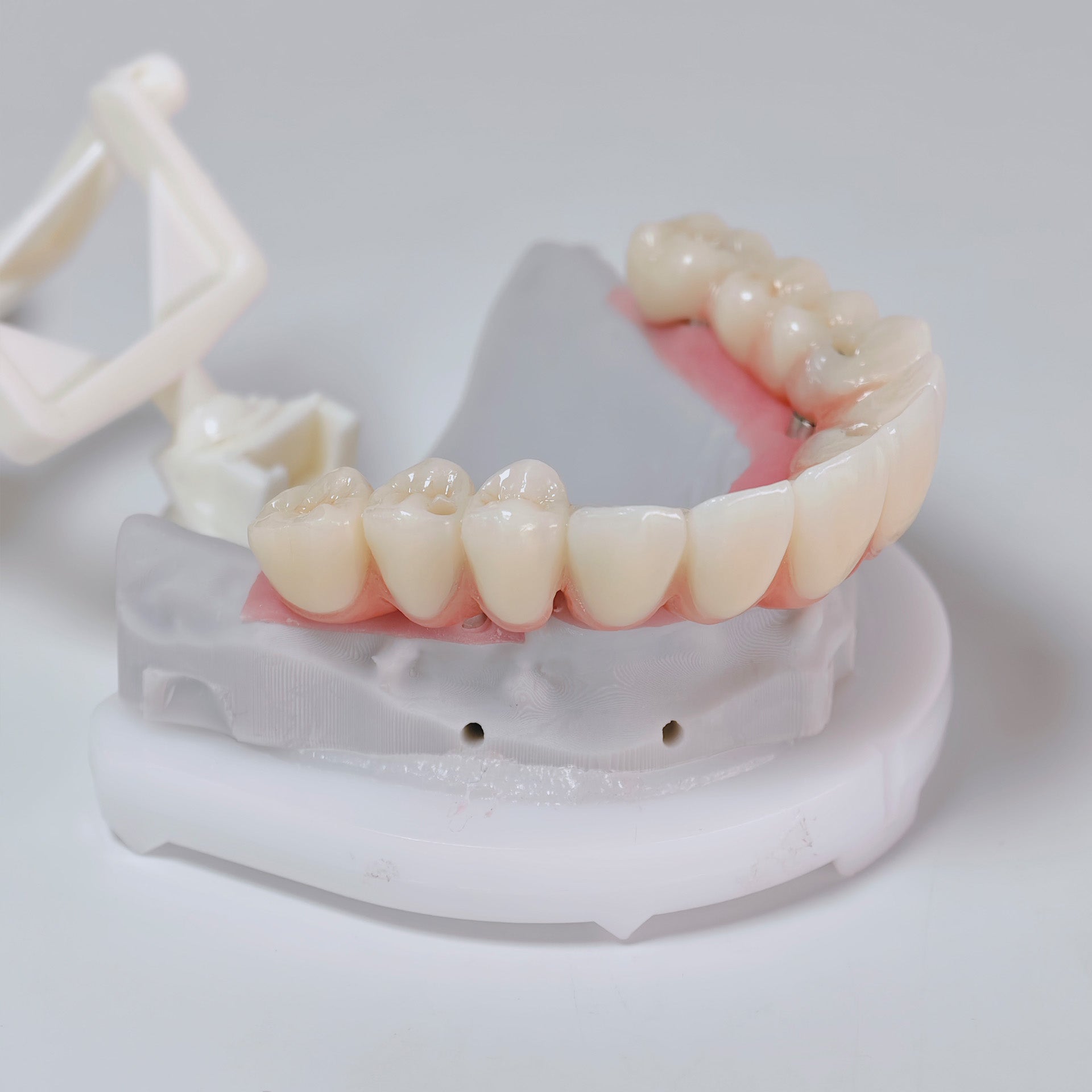 All On 6 Zirconia Bridge With Ti-Base Screw Retained