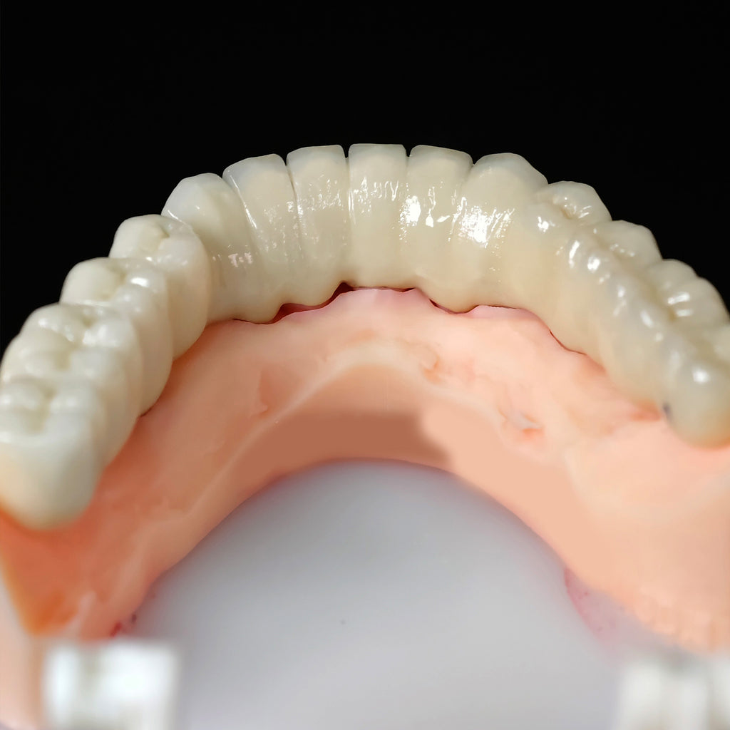 Co - Cr PFM Dental Bridge