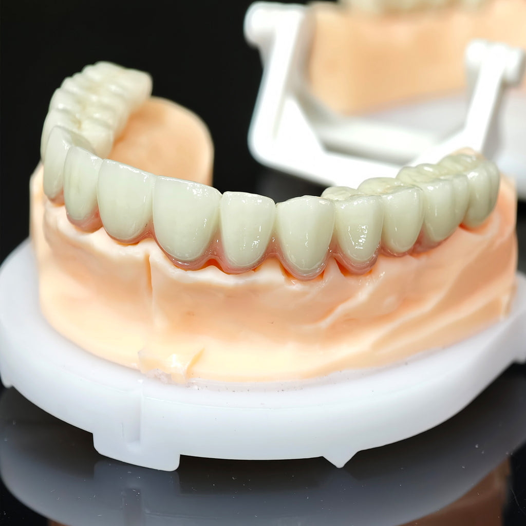 Co - Cr PFM Dental Bridge