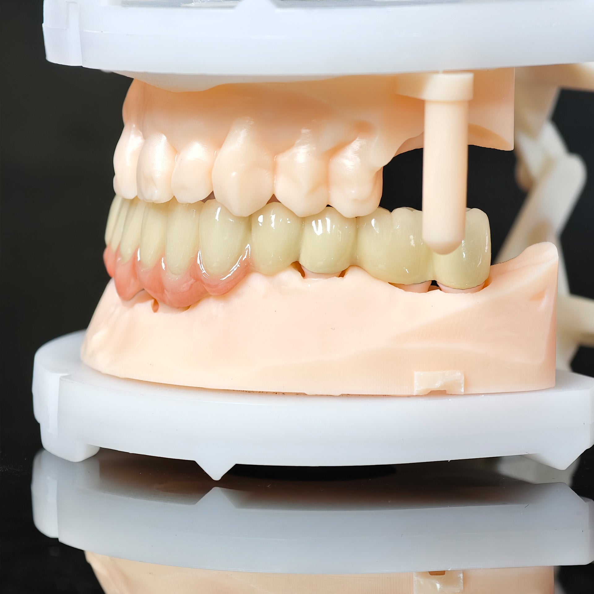 Co - Cr PFM Dental Bridge
