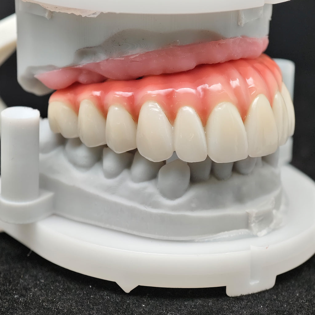 Enhanced Zirconia Crown Malo Bridge