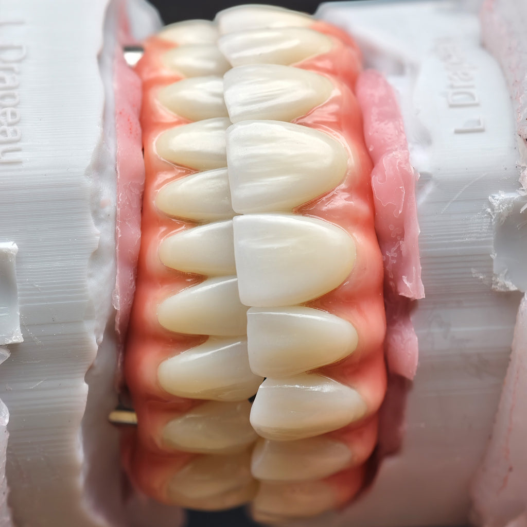 Enhanced Zirconia Crown Malo Bridge