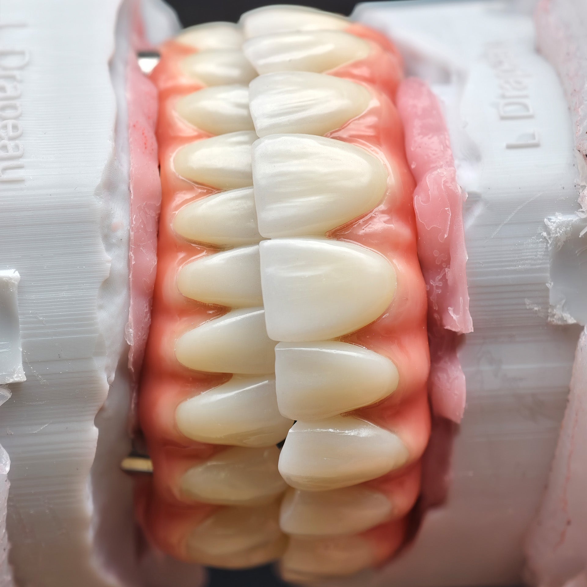 Enhanced Zirconia Crown Malo Bridge