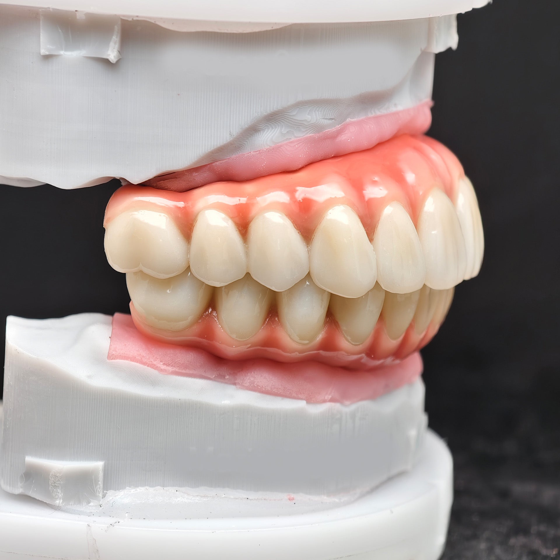 Enhanced Zirconia Crown Malo Bridge