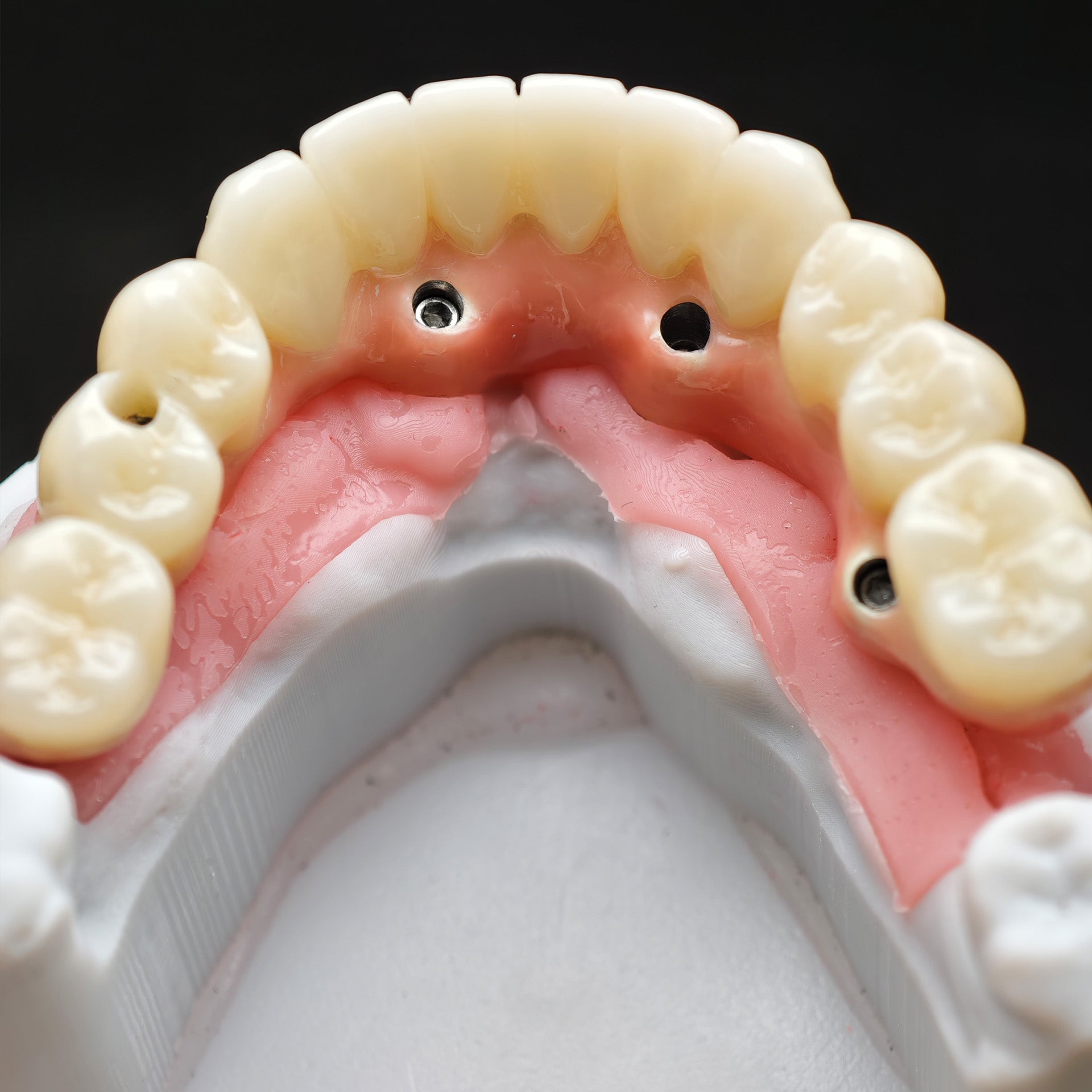 Enhanced Zirconia Crown Malo Bridge