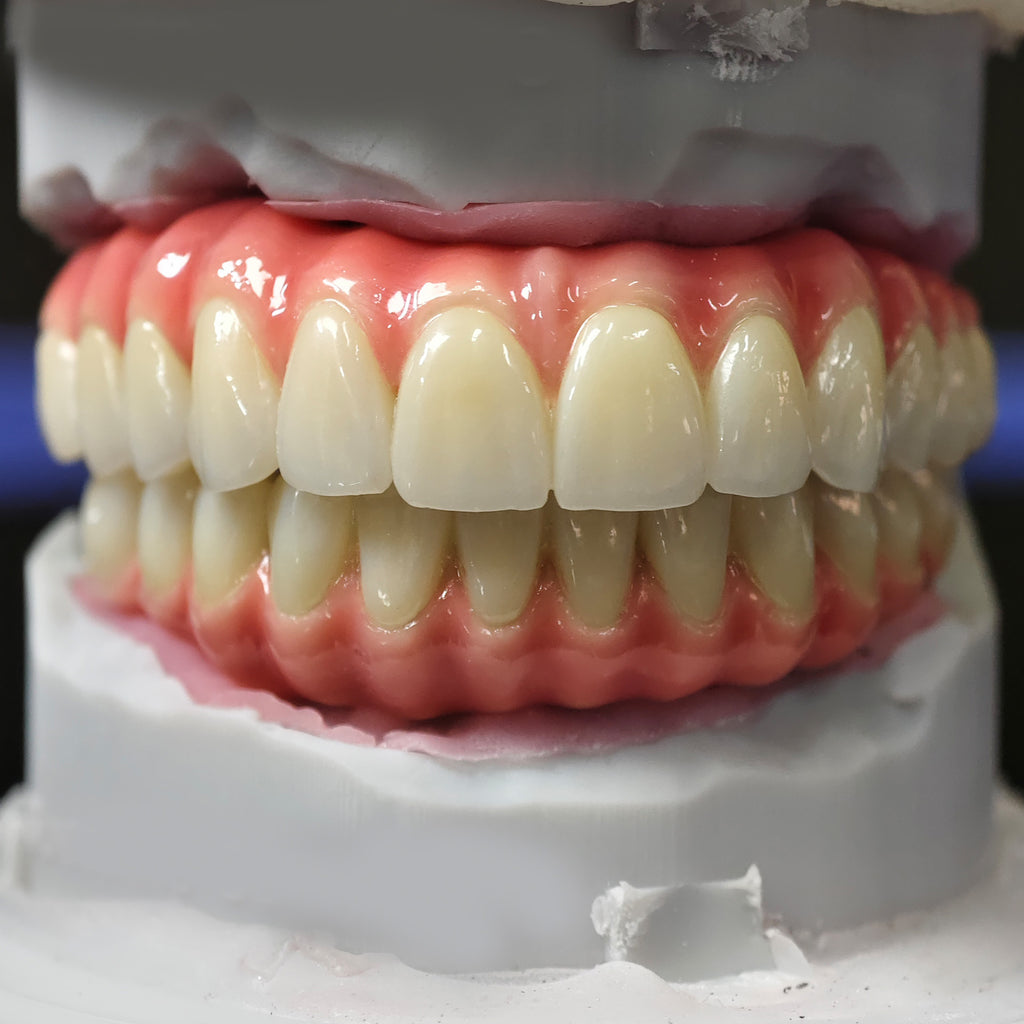 Enhanced Zirconia Crown Malo Bridge