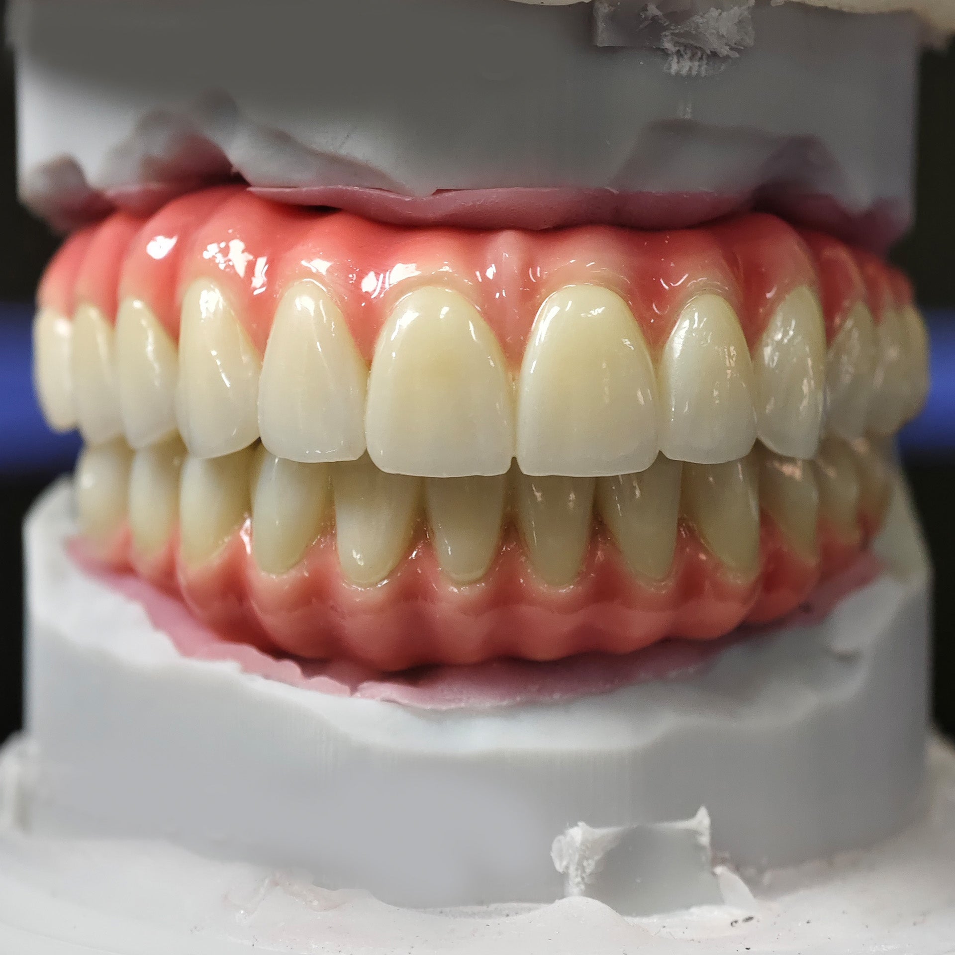 Enhanced Zirconia Crown Malo Bridge