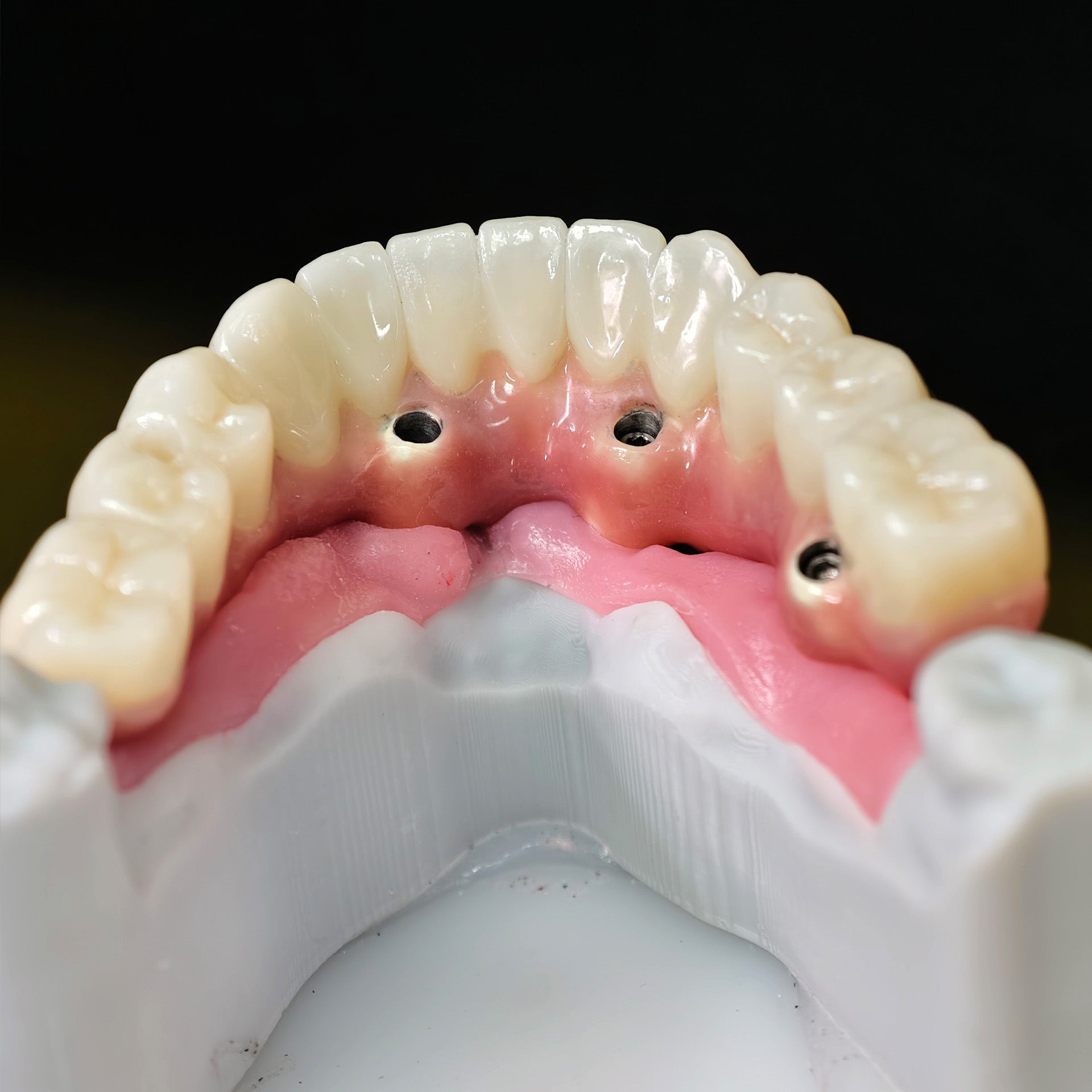 Enhanced Zirconia Crown Malo Bridge
