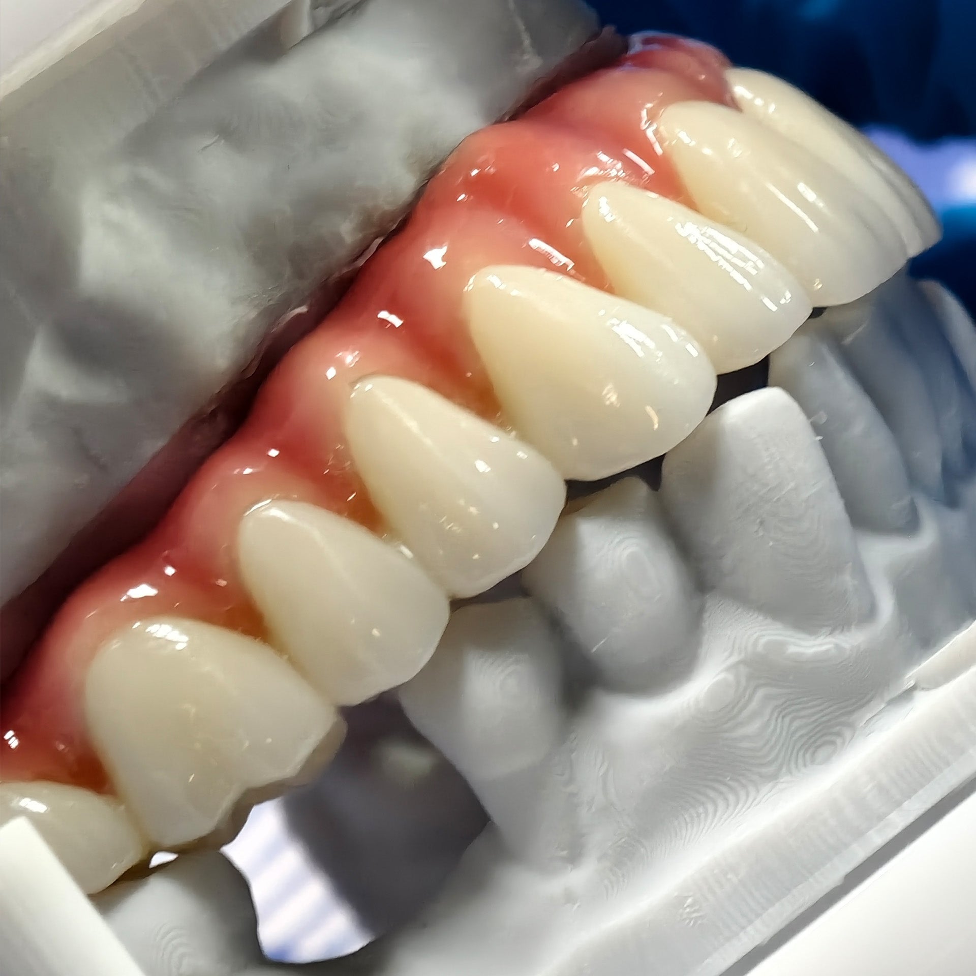 Enhanced Zirconia Crown Malo Bridge