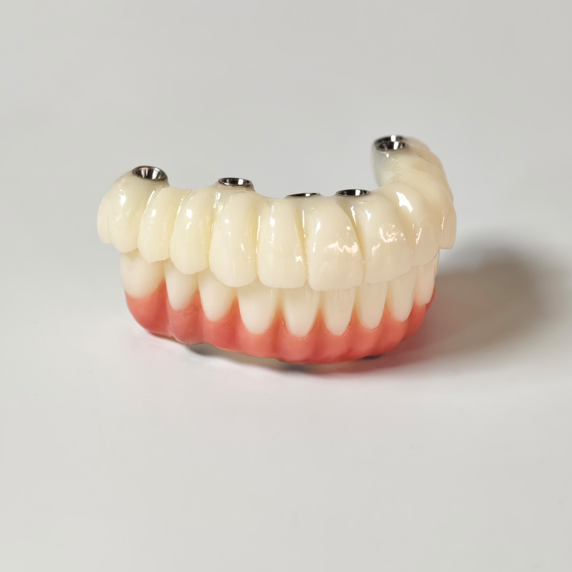 Full-Arch PMMA Bridge With Ti-Base Screw Retained
