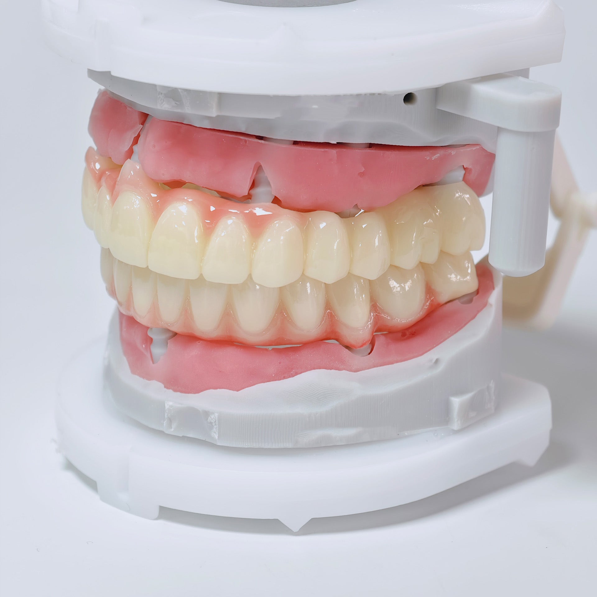 Full-Arch Zirconia Bridge And PMMA Bridge With Cement Retained