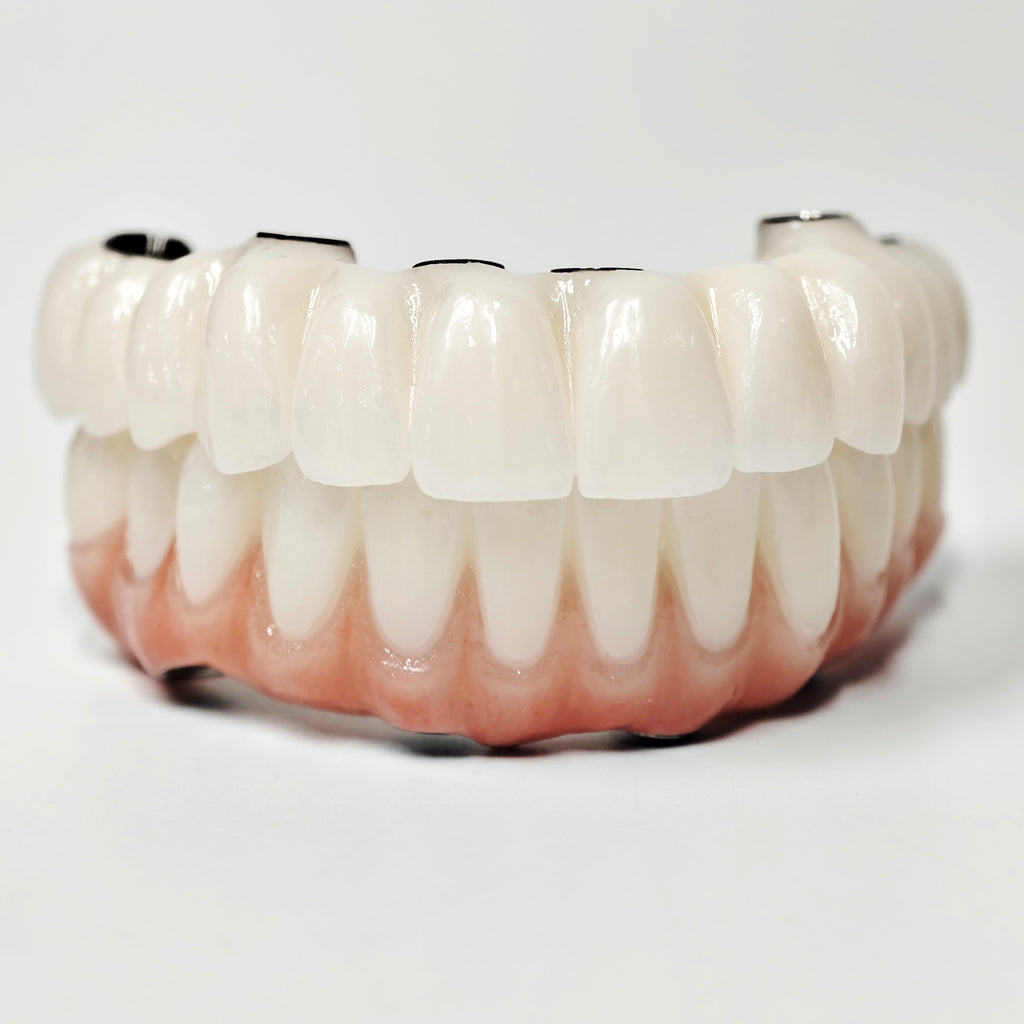 Full-Arch Zirconia Bridge With Ti-Base Abutment