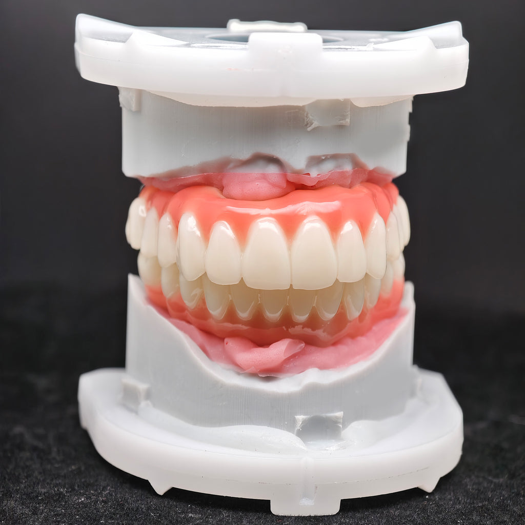 PMMA Bridge With Ti-Base Screw Retained Trying For Full Arch Restoration