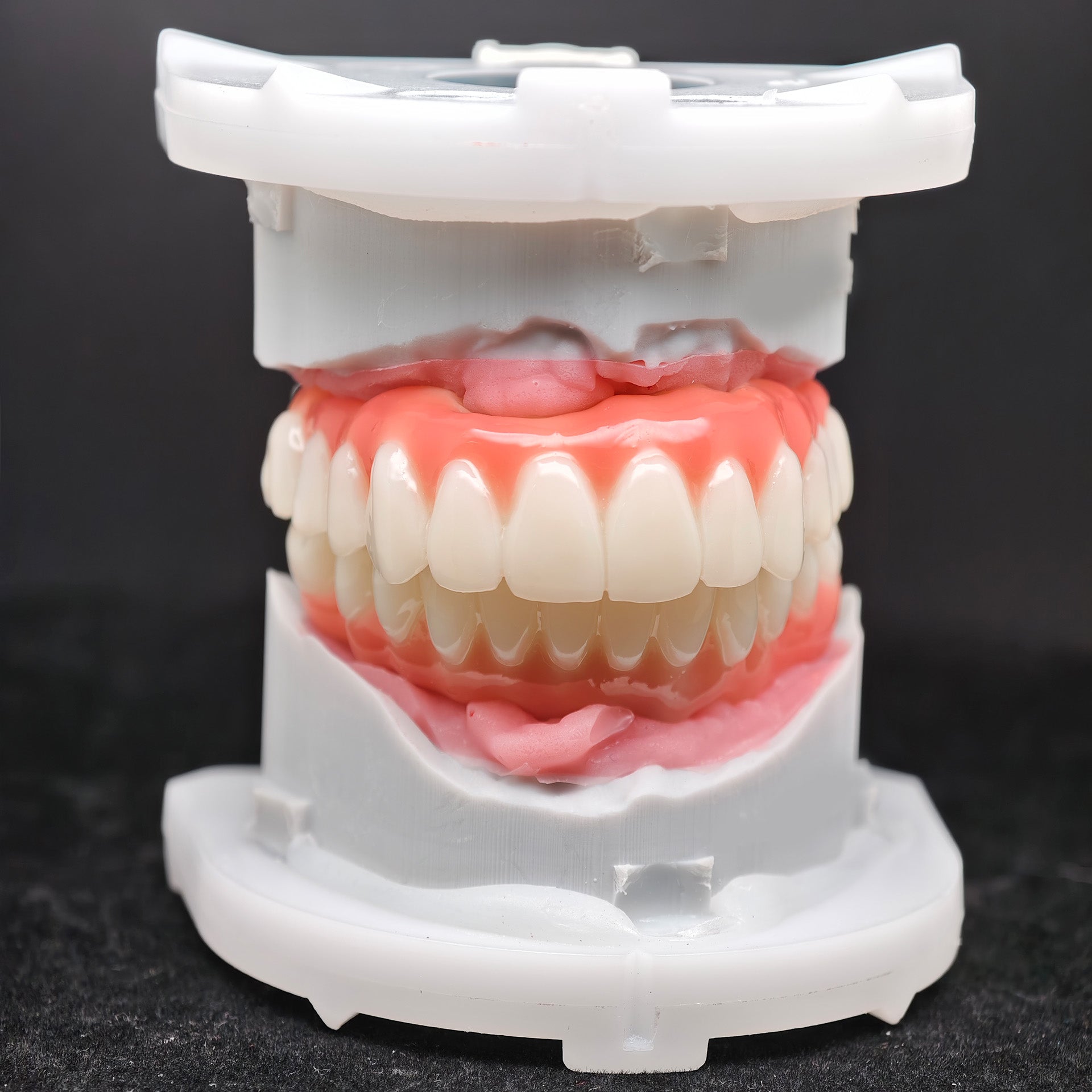 PMMA Bridge With Ti-Base Screw Retained Trying For Full Arch Restoration