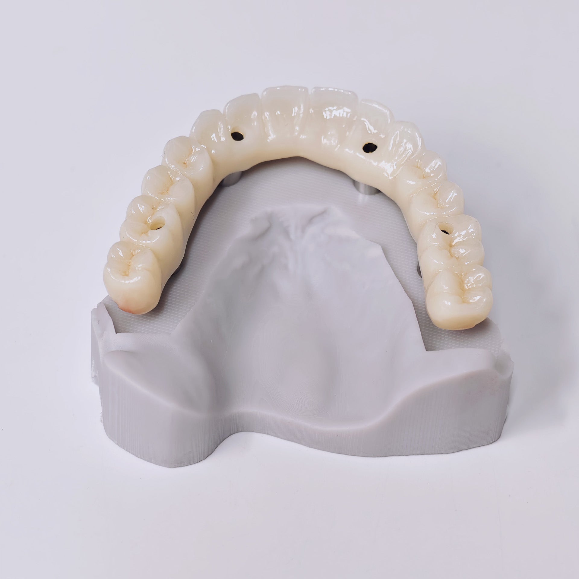 Ti-Bar Titanium Gold-Plated Metal Frame With Zirconia Bridge And Screw Retained