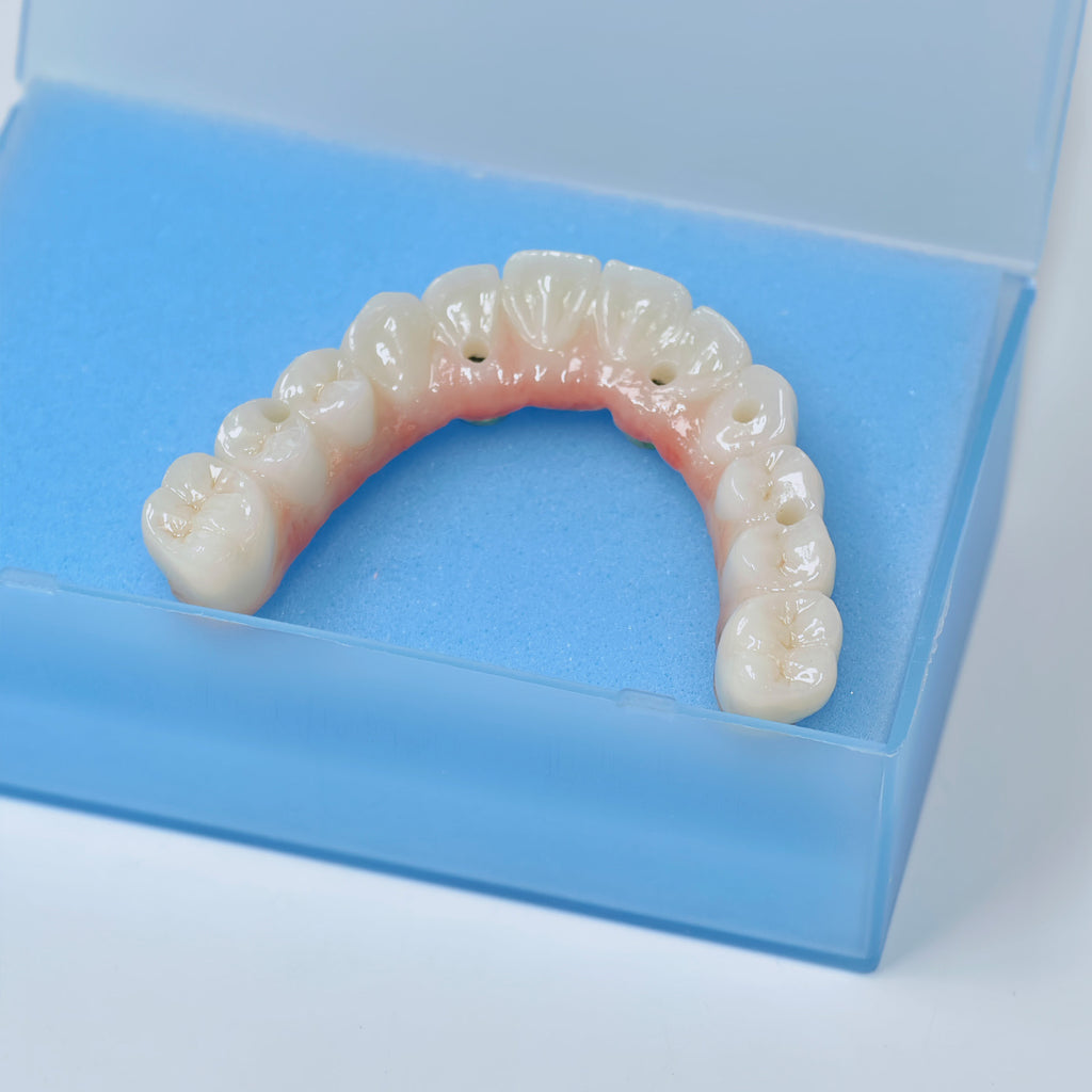 Ti-Bar Titanium Nitride Metal Frame With Zirconia Bridge For Full Arch Restoration