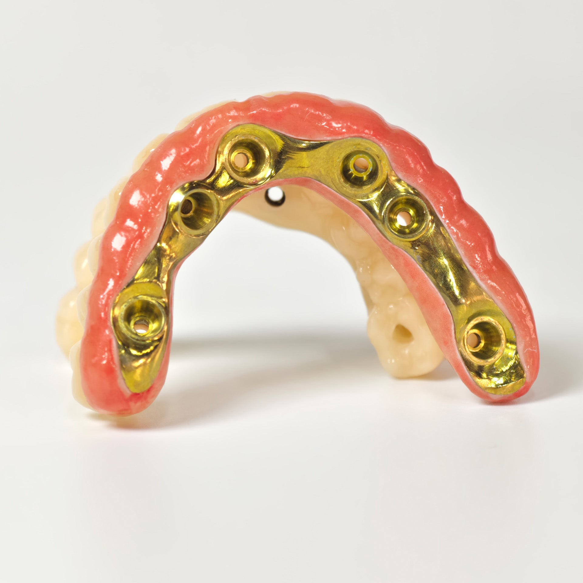 Ti-Bar Titanium Nitride Metal Frame With Zirconia Bridge For Full Arch Restoration