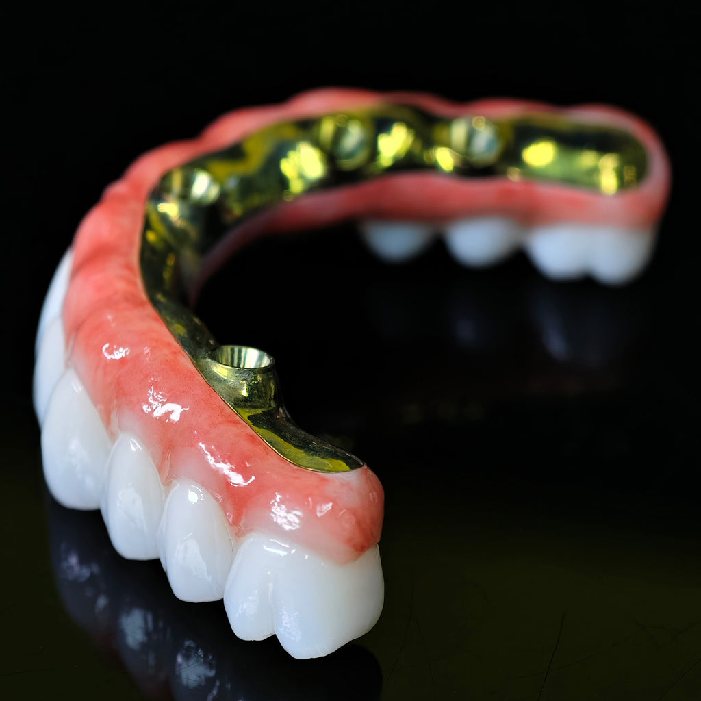 Ti-Bar Titanium Nitride Metal Frame With Zirconia Bridge For Full Arch Restoration