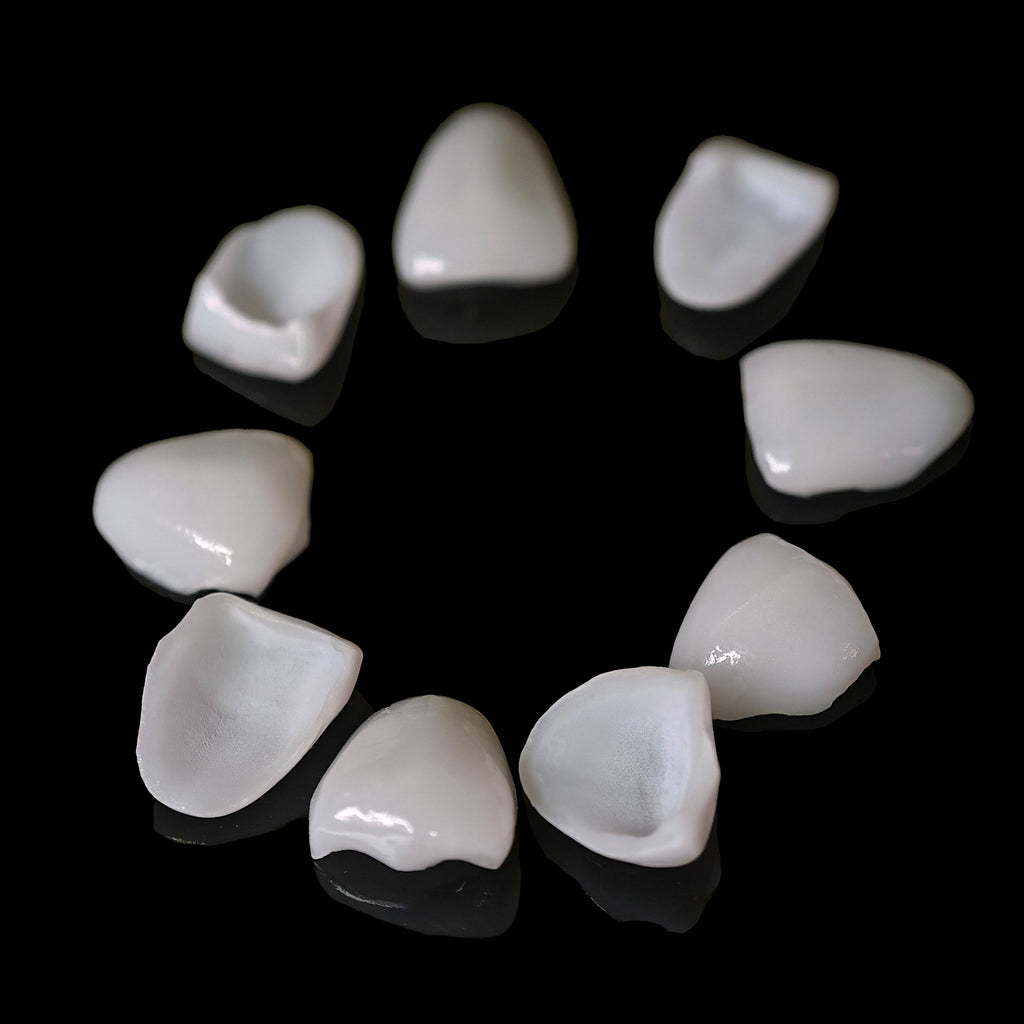 Ultra-Thin Emax Veneer. High Transparency/Translucent, Natural Shade