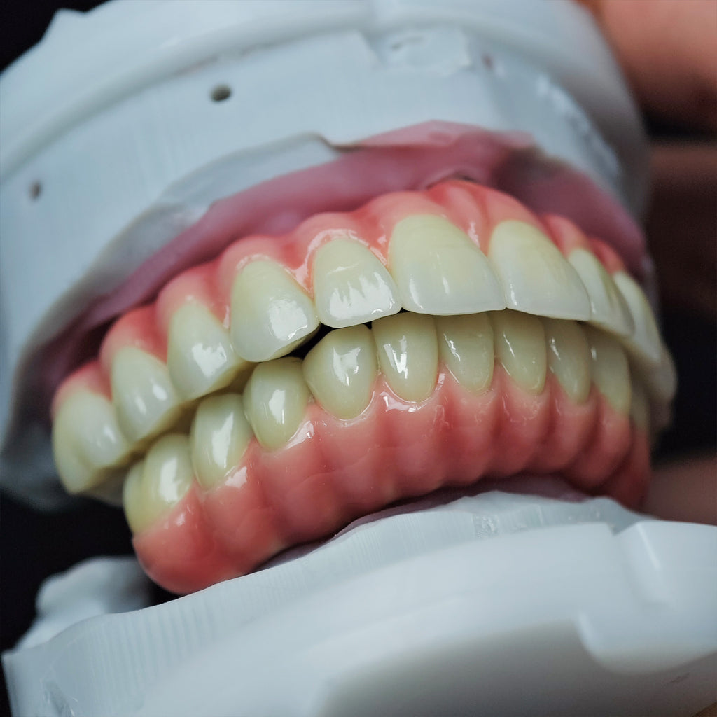 Zirconia-Enamel Hybrid Malo Bridge