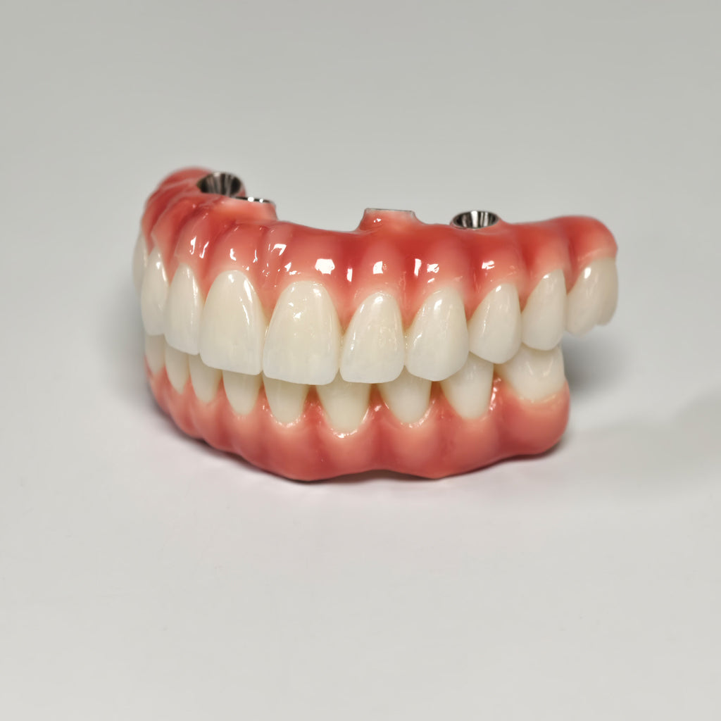 Zirconia-Enamel Hybrid Malo Bridge