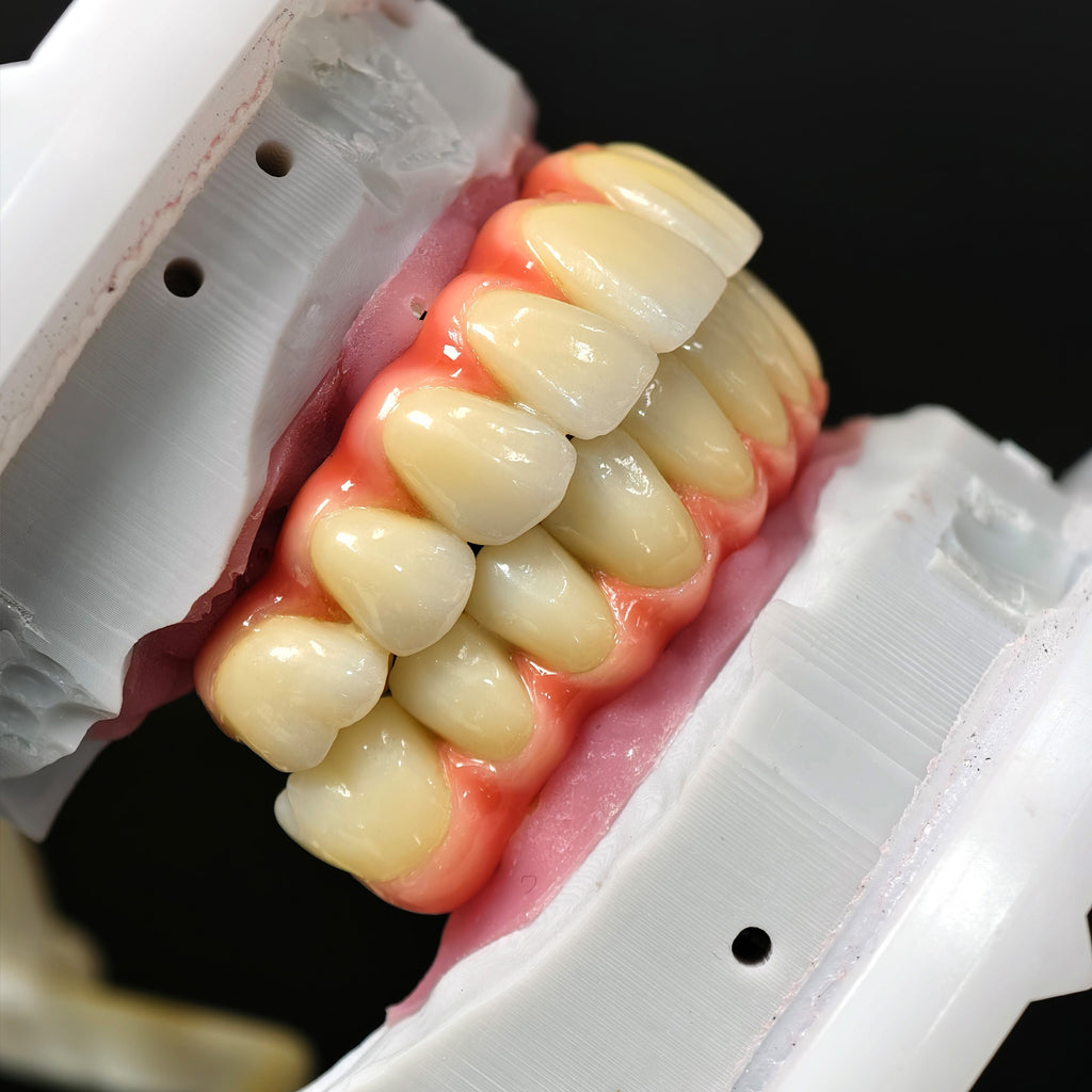 Zirconia-Enamel Hybrid Malo Bridge