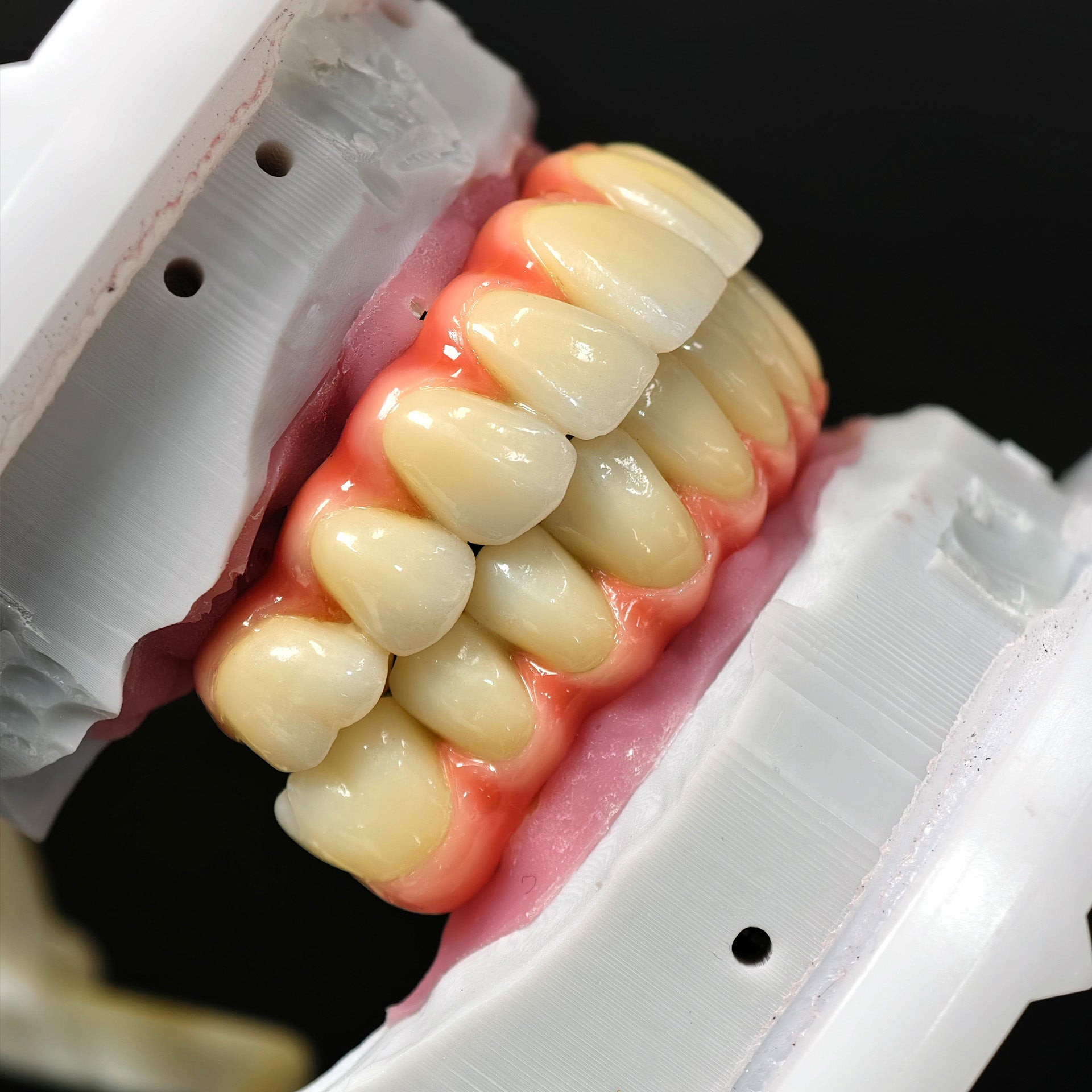 Zirconia-Enamel Hybrid Malo Bridge