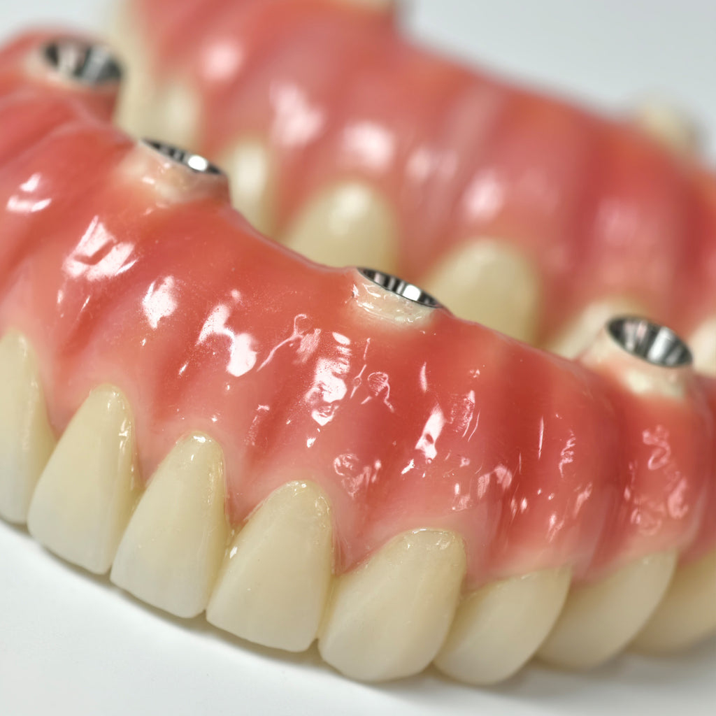 Zirconia-Enamel Hybrid Malo Bridge