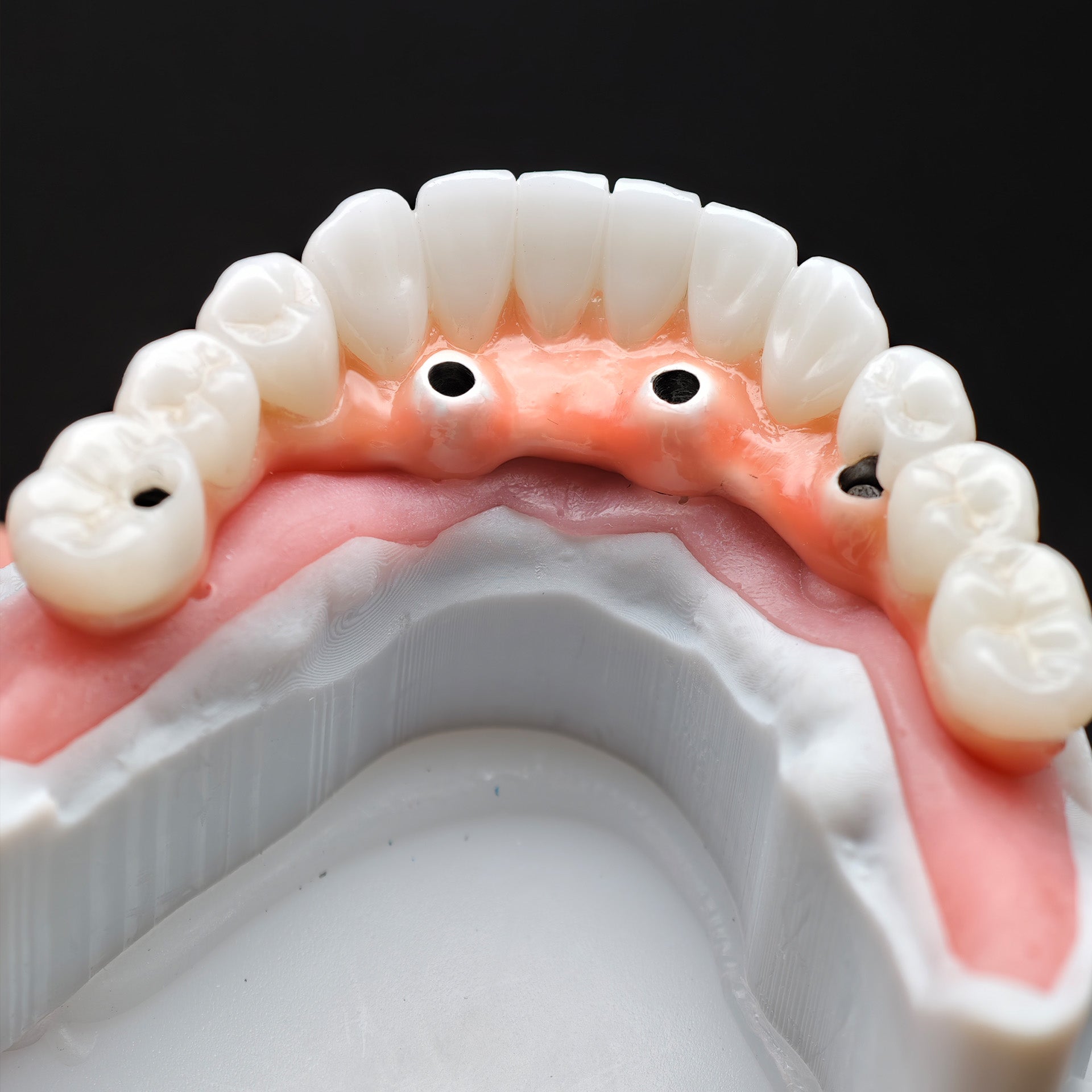 Zirconia-Enamel Hybrid Malo Bridge