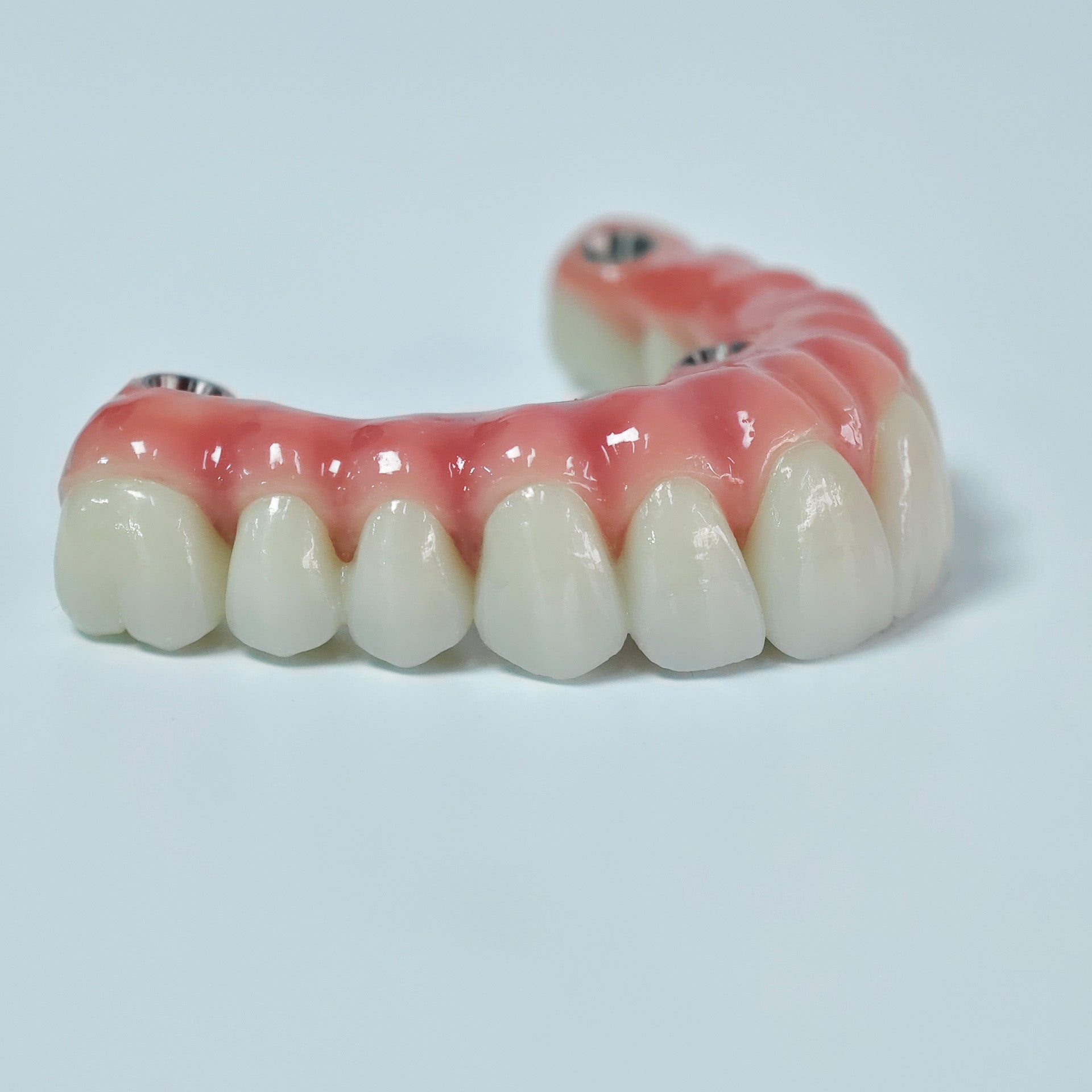 Zirconia-Enamel Hybrid Malo Bridge