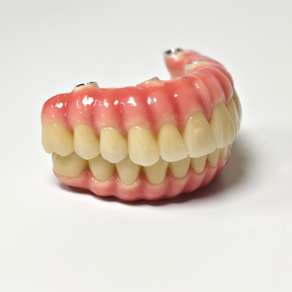 Zirconia-Enamel Hybrid Malo Bridge