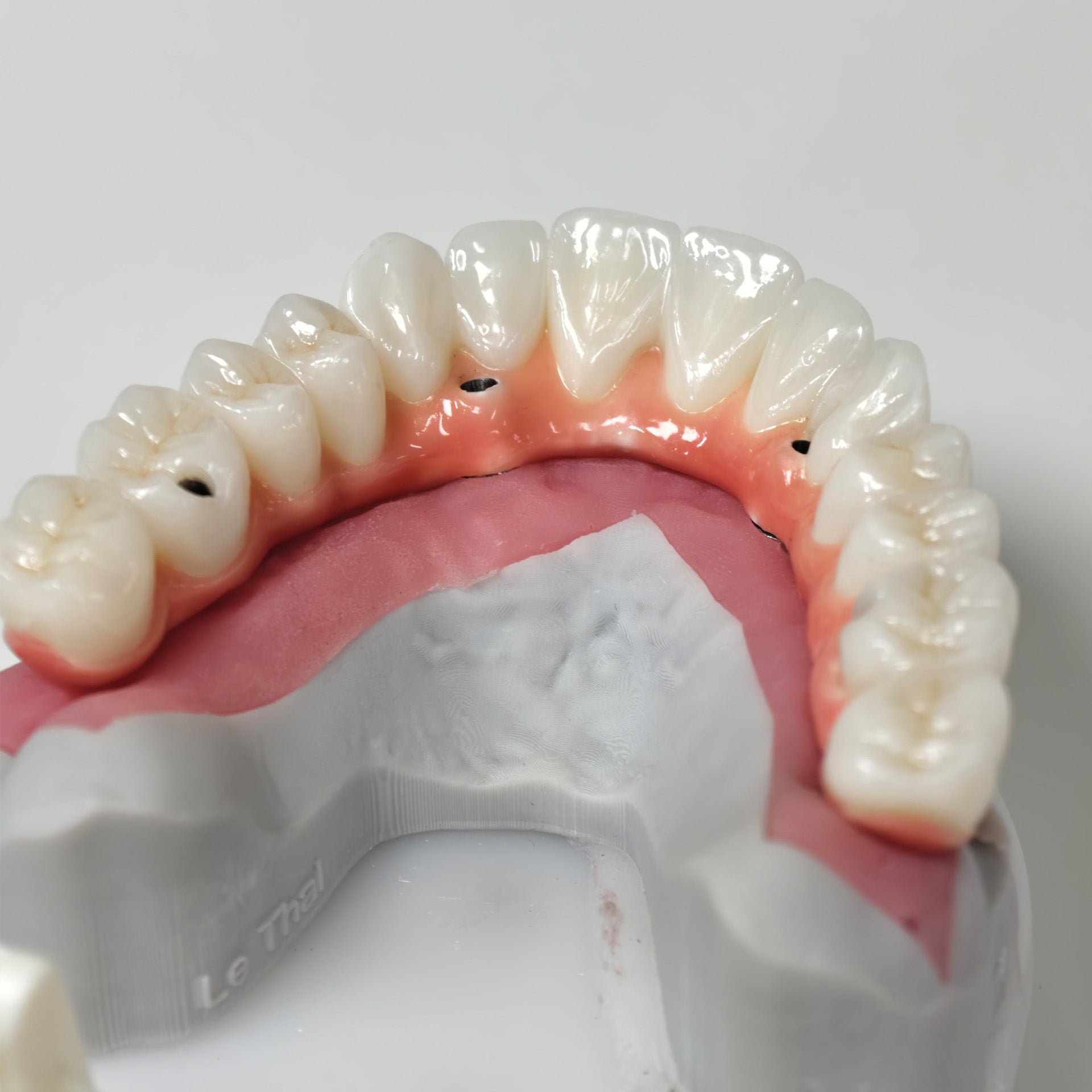 Zirconia-Enamel Hybrid Malo Bridge