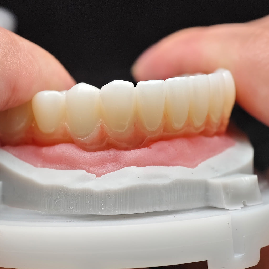 Zirconia Bridge With Cement Retained