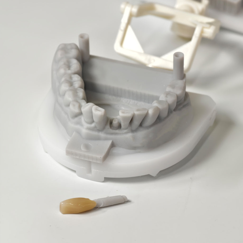 Zirconia Implant Bridge Screwmentable Dental Crown