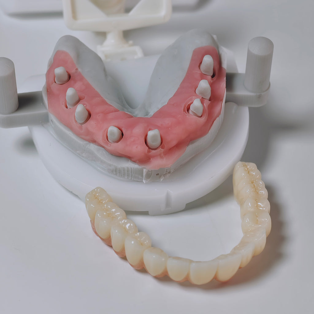 Zirconia Implant Bridges Screwmentable Dental Crown