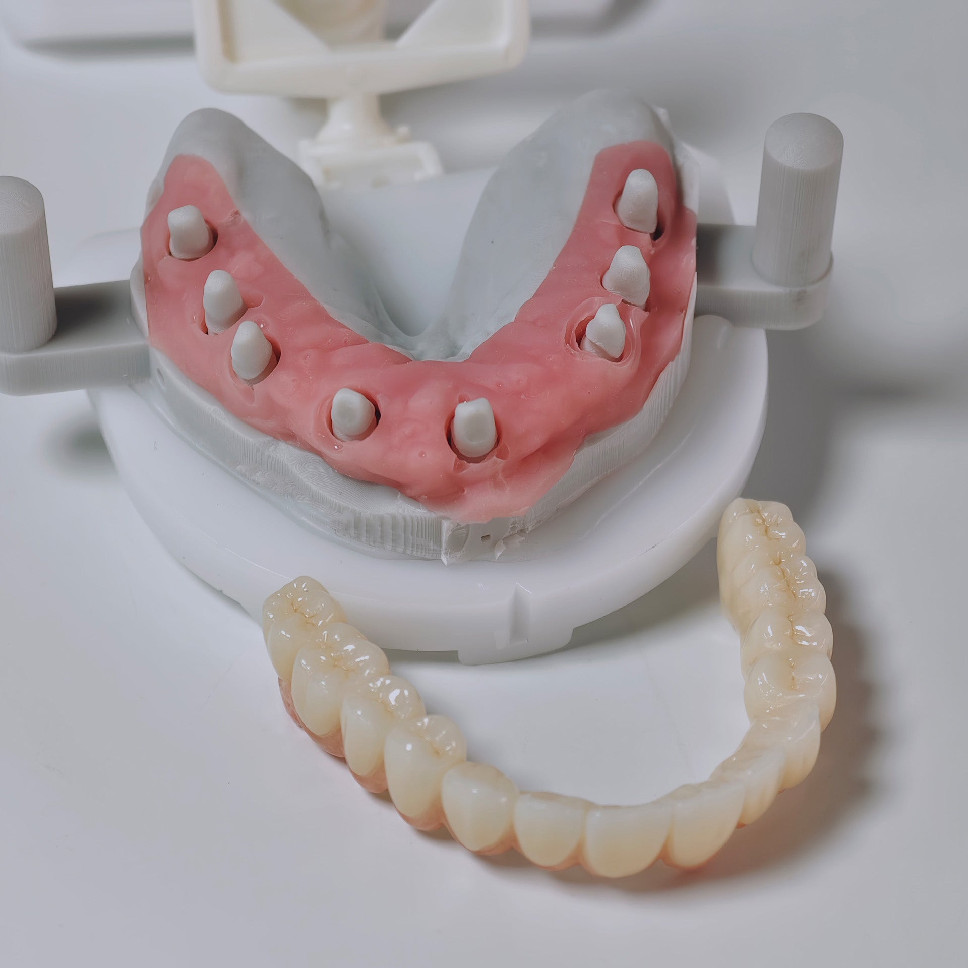 Zirconia Implant Bridges Screwmentable Dental Crown