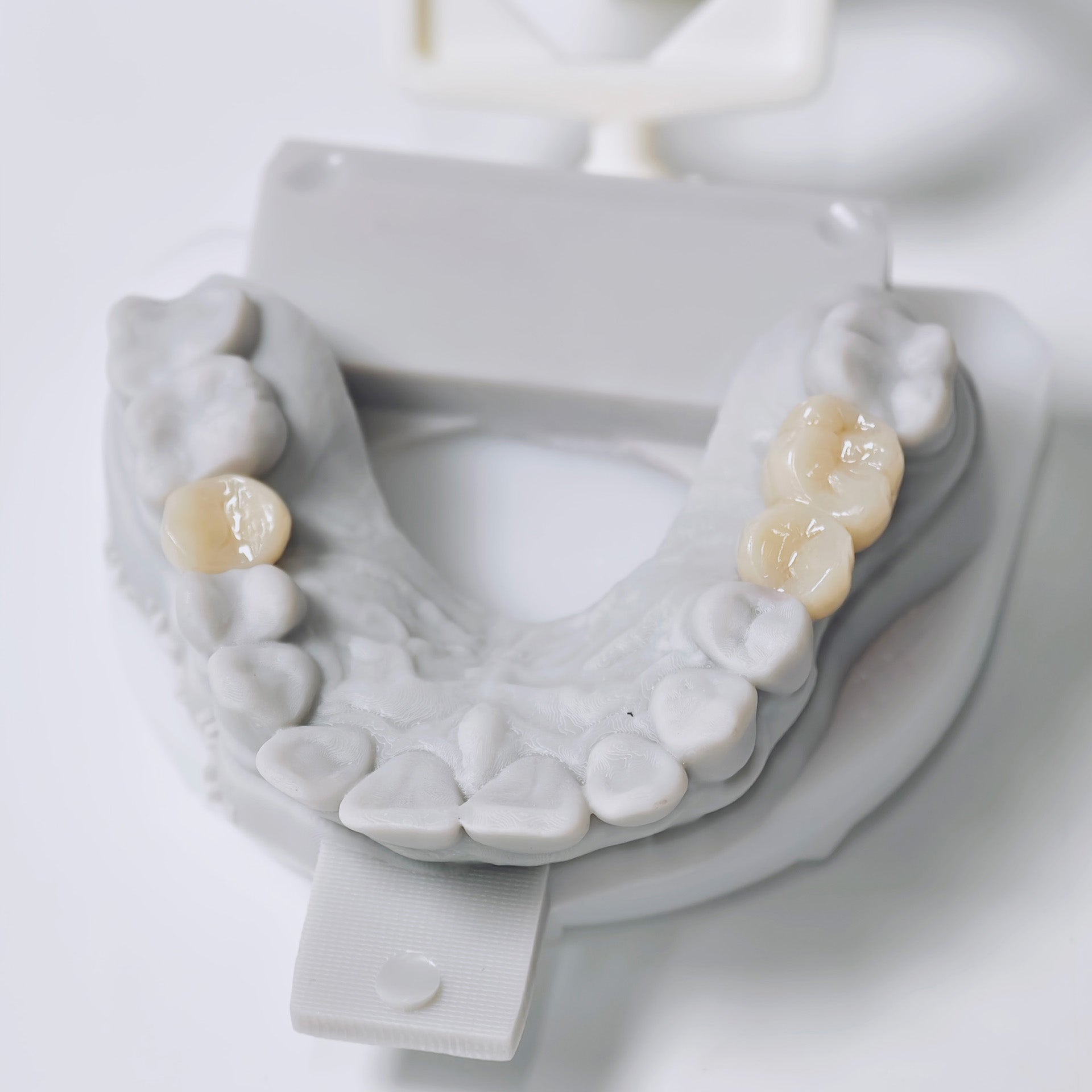 Zirconia Implant Crowns And Bridges Screwmentable Dental Crown