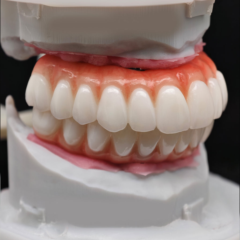 All On 4 Zirconia Bridge With Ti-Base Screw Retained Trying For Full Arch Restoration