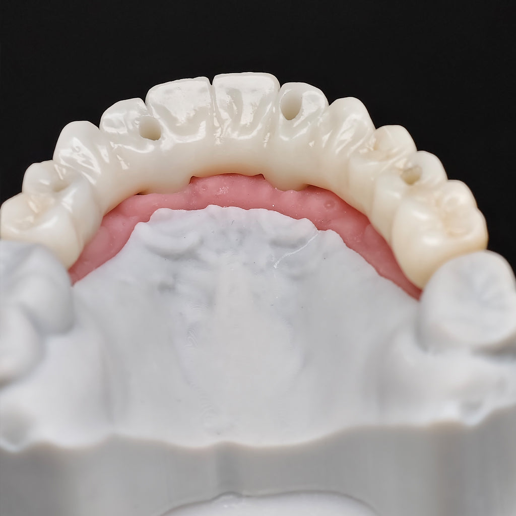 All On 4 Zirconia Bridge With Ti-Base Screw Retained Trying For Full Arch Restoration