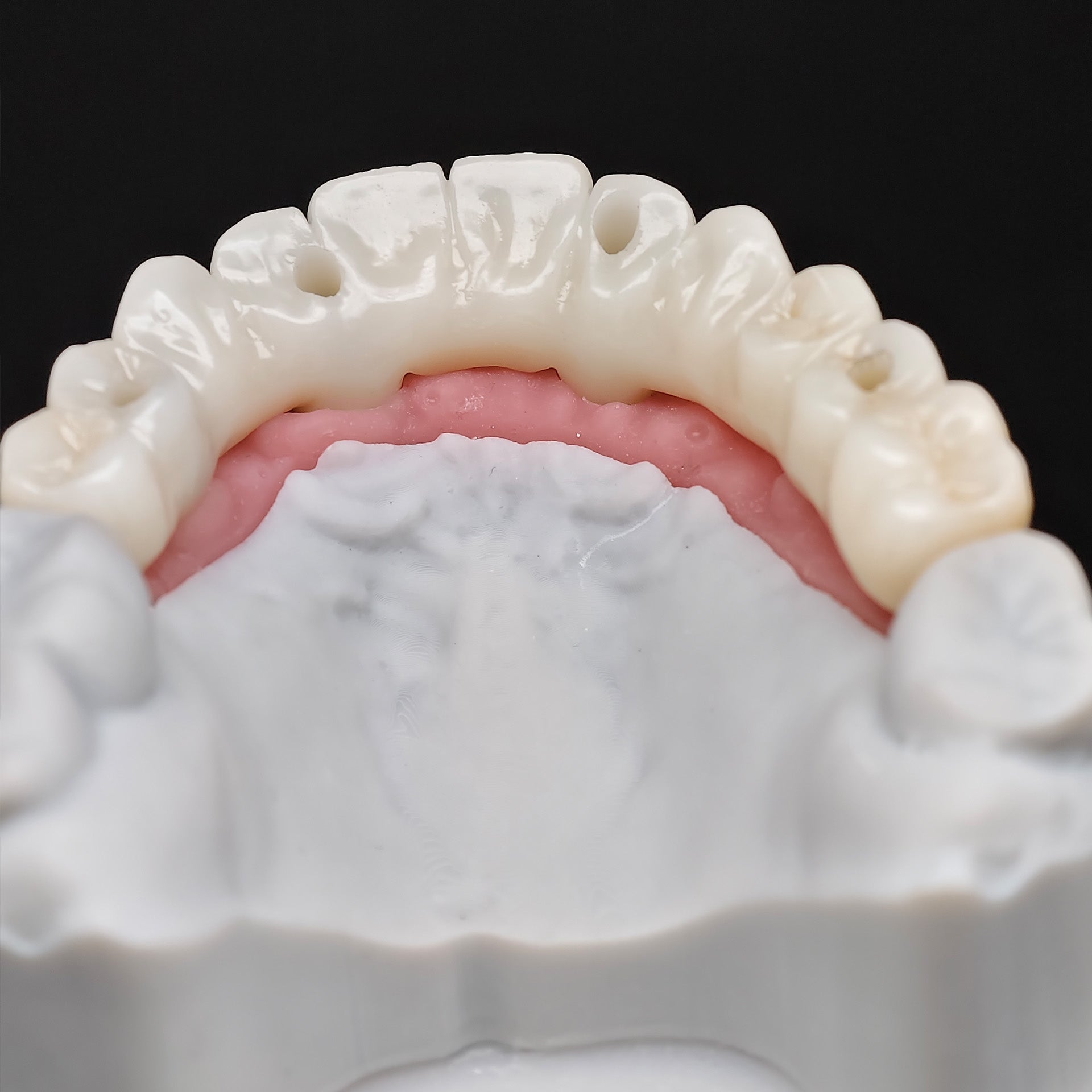 All On 4 Zirconia Bridge With Ti-Base Screw Retained Trying For Full Arch Restoration