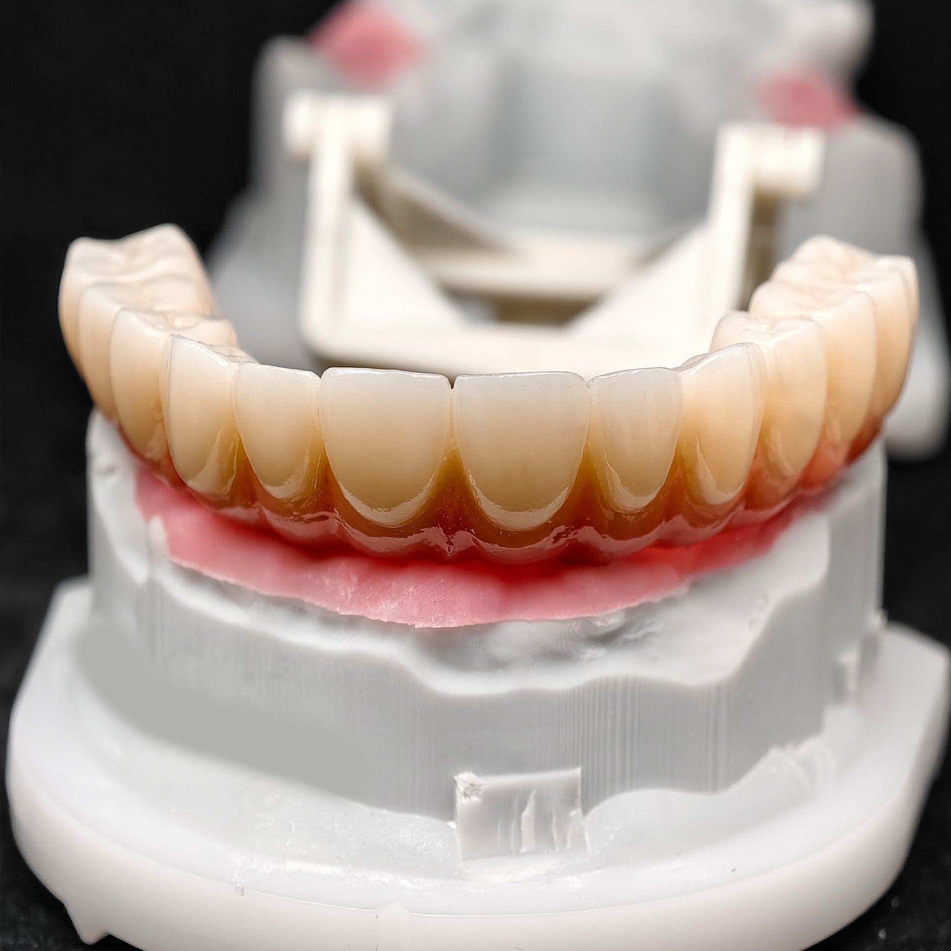 All On 4 Zirconia Bridge With Ti-Base Screw Retained Trying For Full Arch Restoration