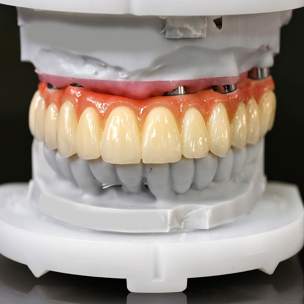 All On 5 Zirconia Bridge With Ti-Base Screw Retained Trying For Full Arch Restoration
