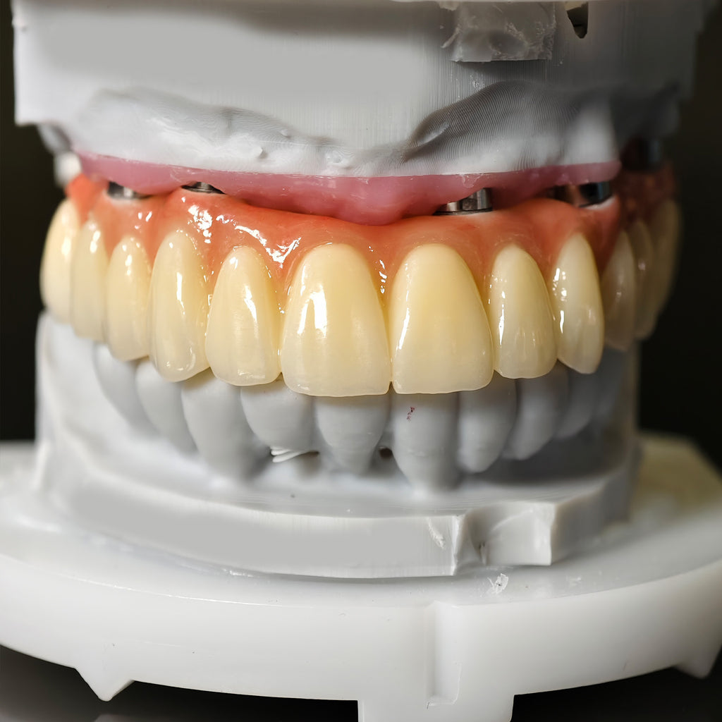 All On 5 Zirconia Bridge With Ti-Base Screw Retained Trying For Full Arch Restoration