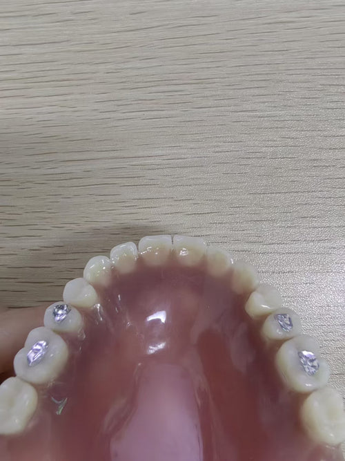 Acrylic Denture Meharry Acrylic Metal On Surface Customized Denture