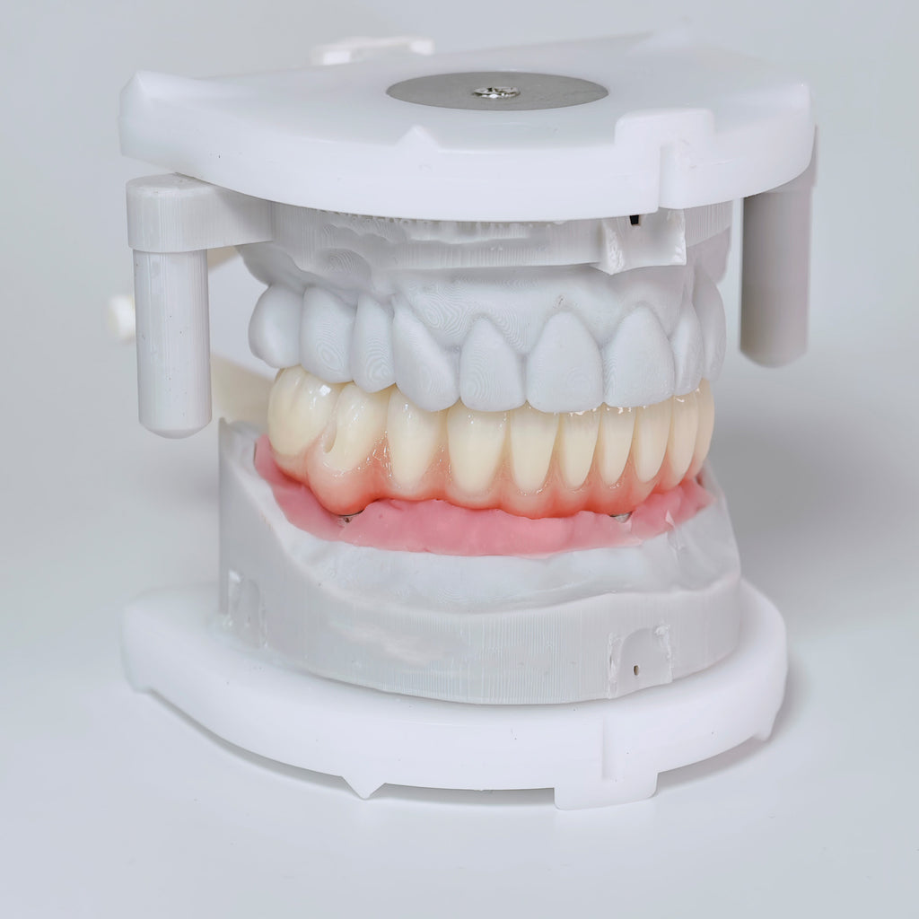 All On 4 Zirconia Bridge With Ti-Base Screw Retained