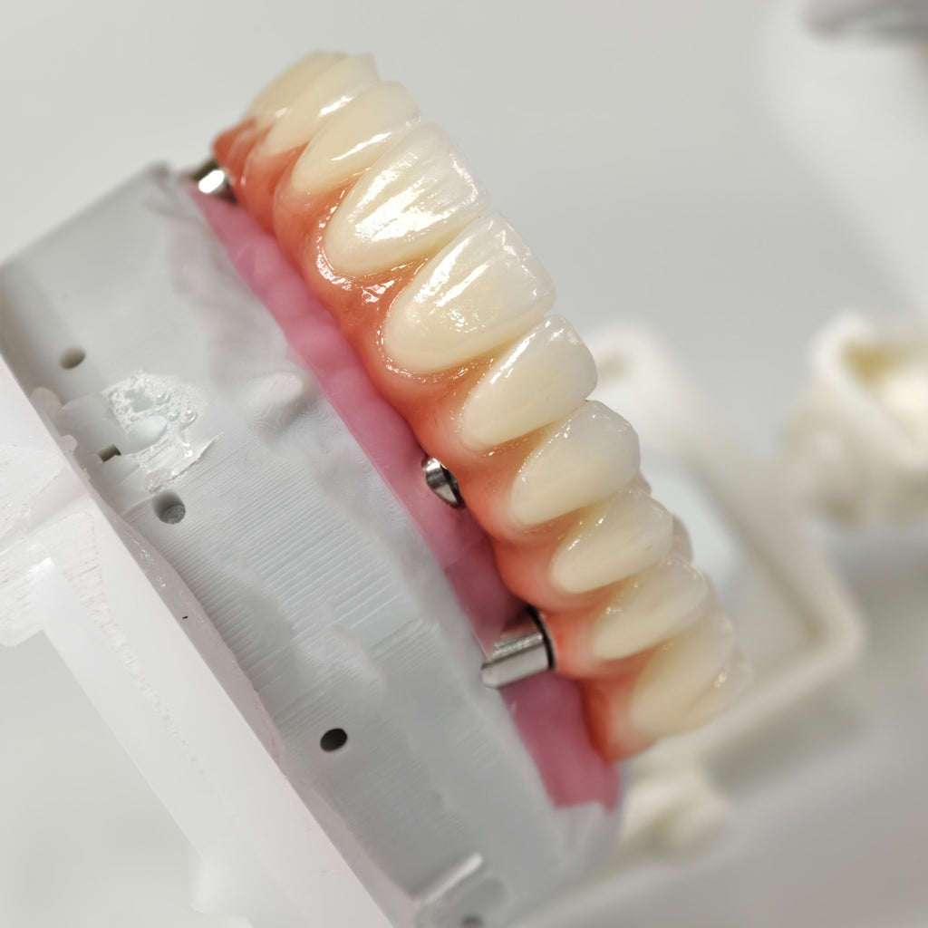 All On 5 Zirconia Bridge With Ti-Base Screw Retained