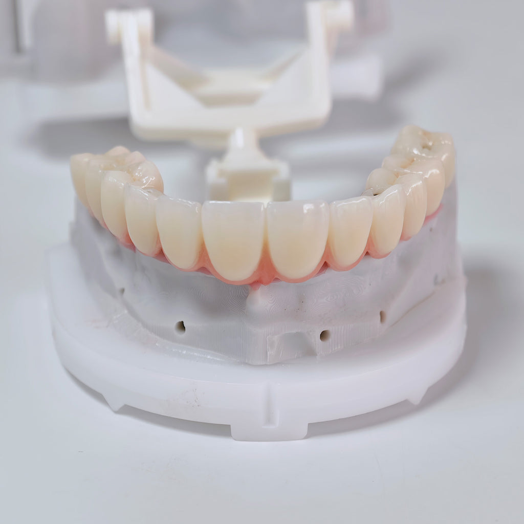 All On 6 Zirconia Bridge With Ti-Base Screw Retained