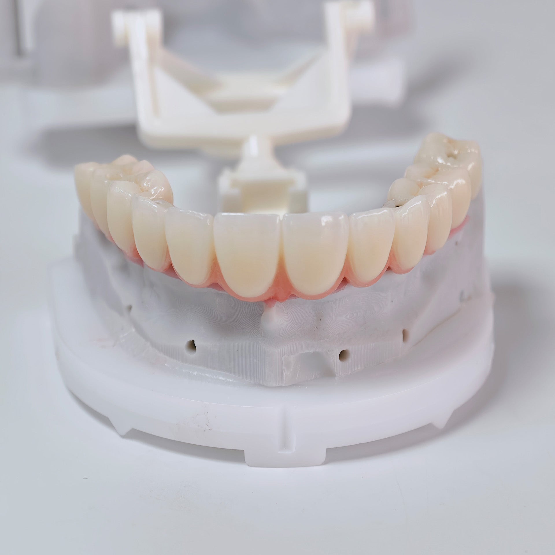 All On 6 Zirconia Bridge With Ti-Base Screw Retained