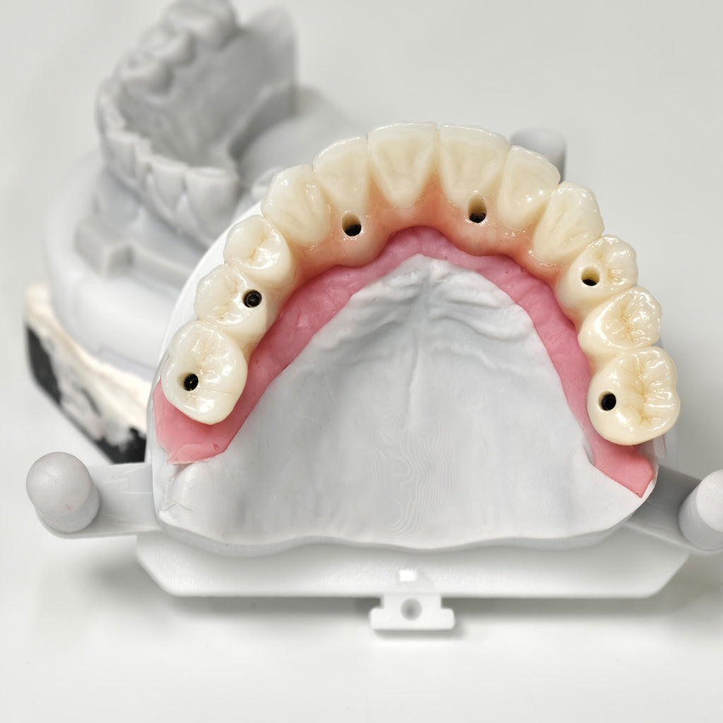 All On 6 Zirconia Bridge With Ti-Base Screw Retained